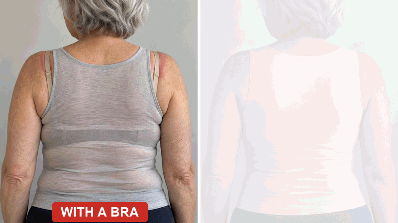 The same woman from behind: red strap marks and a roll over the bra band, next to a smooth back in the tank